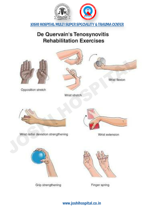 dequervian tenosynovitis Exercise Chart